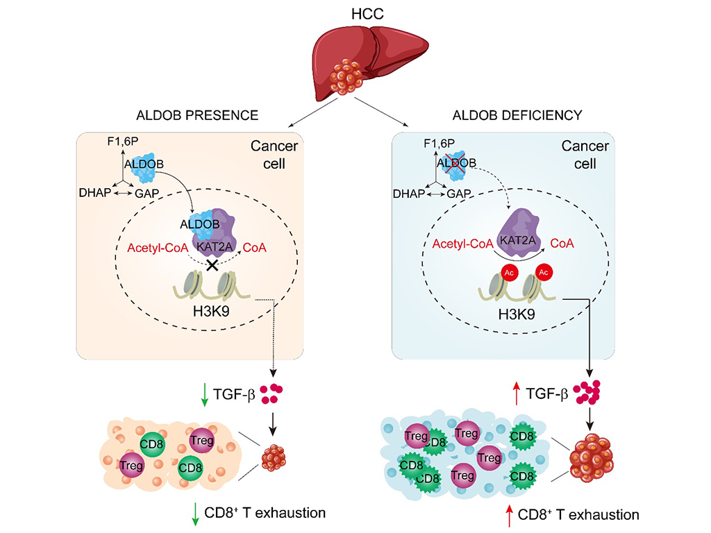 Summary diagram: ALDOB/KAT2A interaction epigenetically regulates TGF-β expression and T cells in HCC.