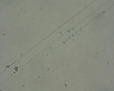 Appearance of Cracks After the Cyclic Bending Test