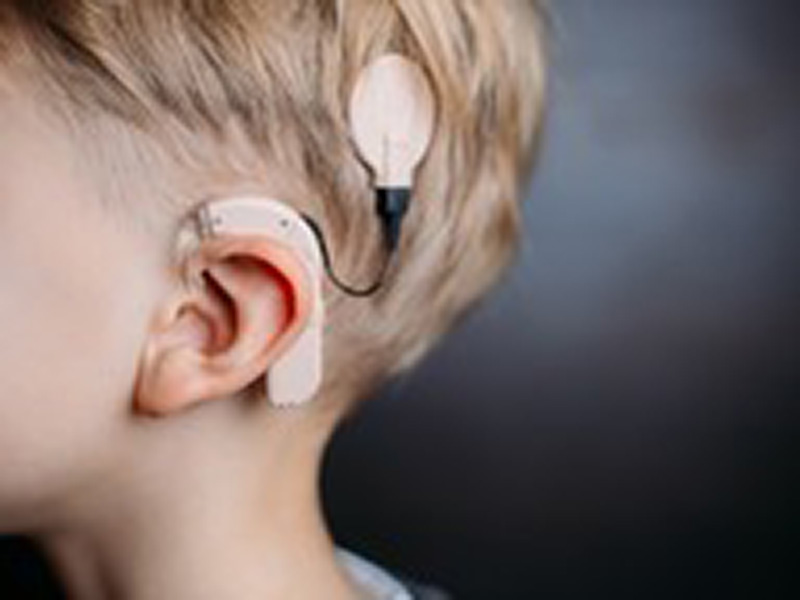 Animal experiments demonstrated the need for new cochlear implant design for localising sound directions