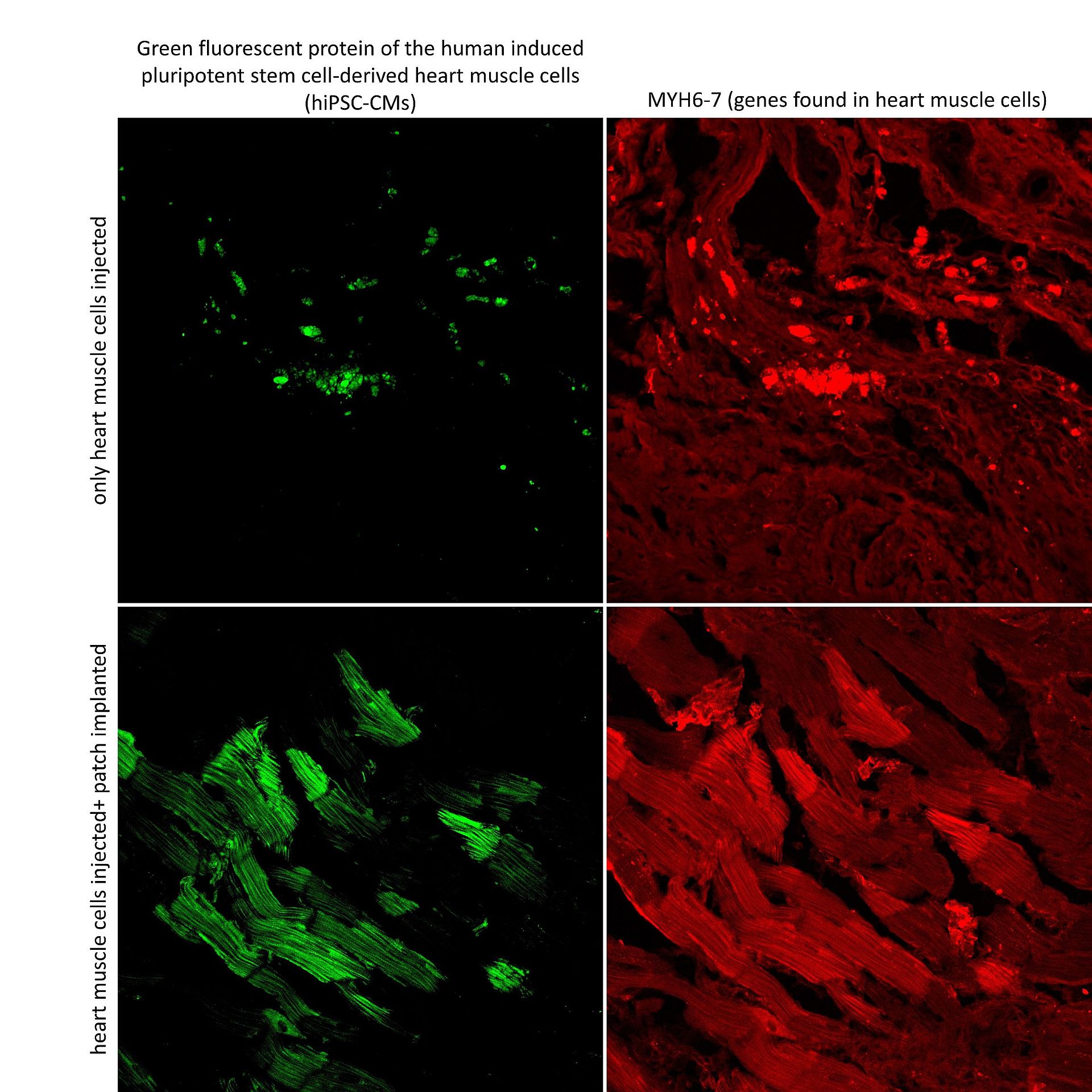 Results of CM and CM+PA Group Compared