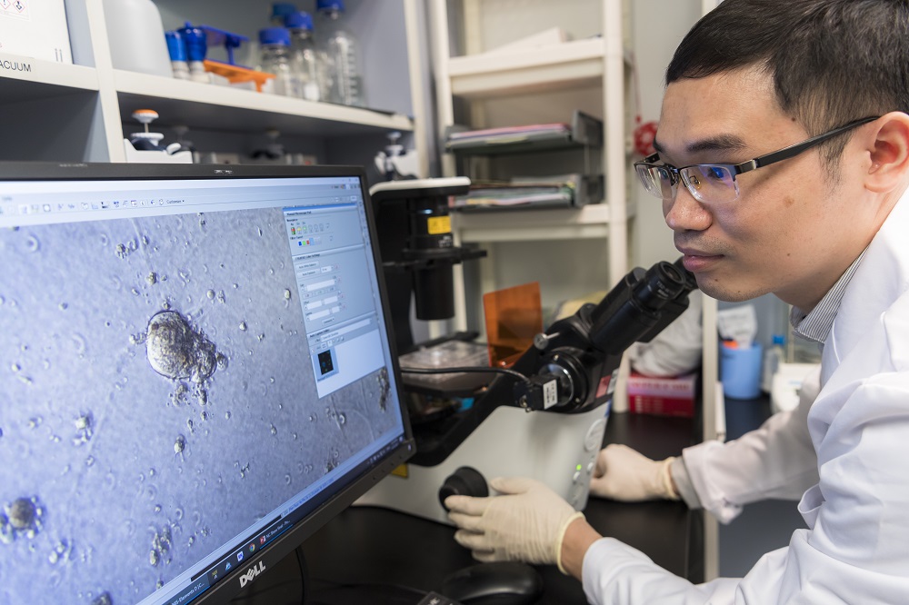 香港城大生物學家找出令「三陰性乳腺癌」致癌基因活躍的超級增強子
