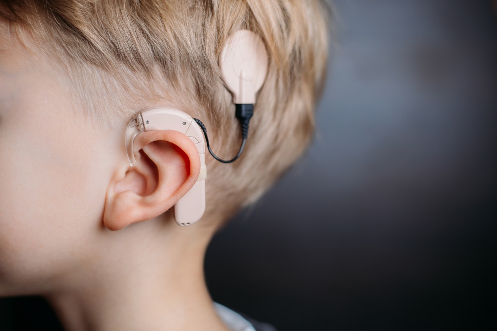 Animal experiments demonstrated the need for new cochlear implant design for localising sound directions