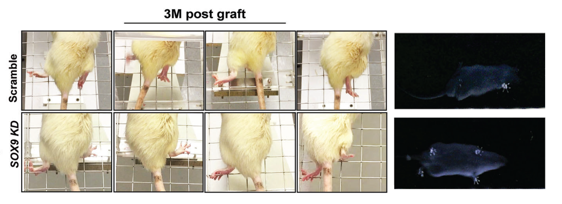 human neural stem cells 