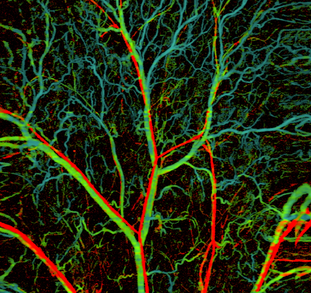 城大學者研發超靈敏光聲顯微鏡 具廣泛生物醫學應用潛力