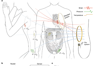 Prof. YU Xinge Participates in Study about Soft Biodegradable Implants