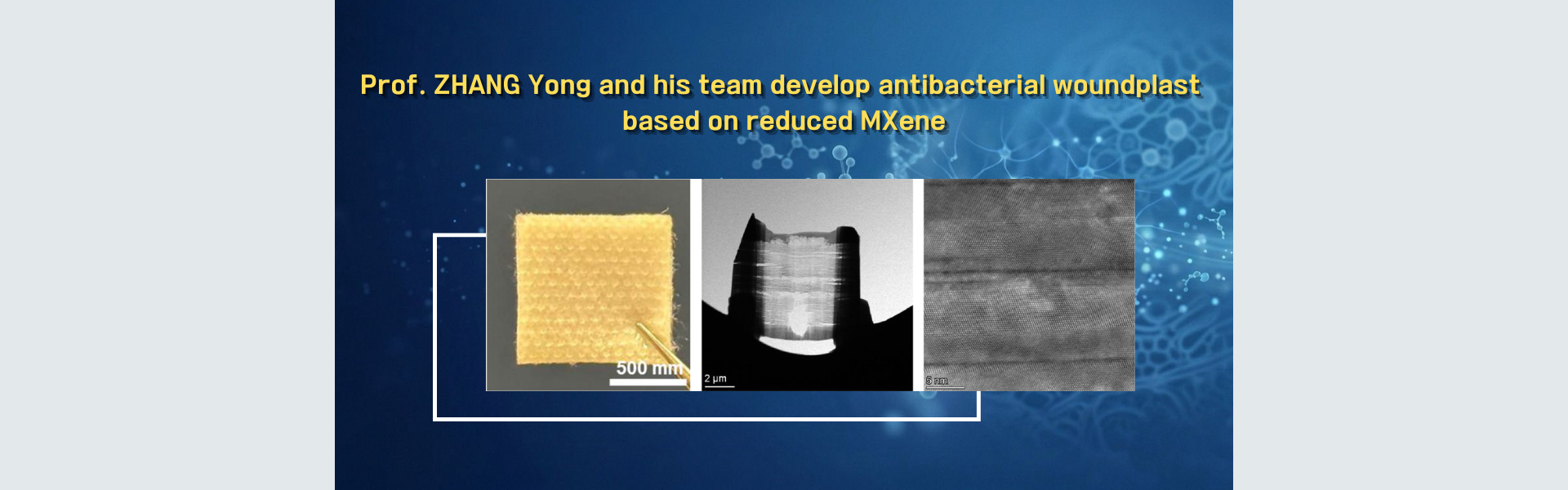 Prof. Zhang Yong and his team develop antibacterial woundplast based on reduced MXene