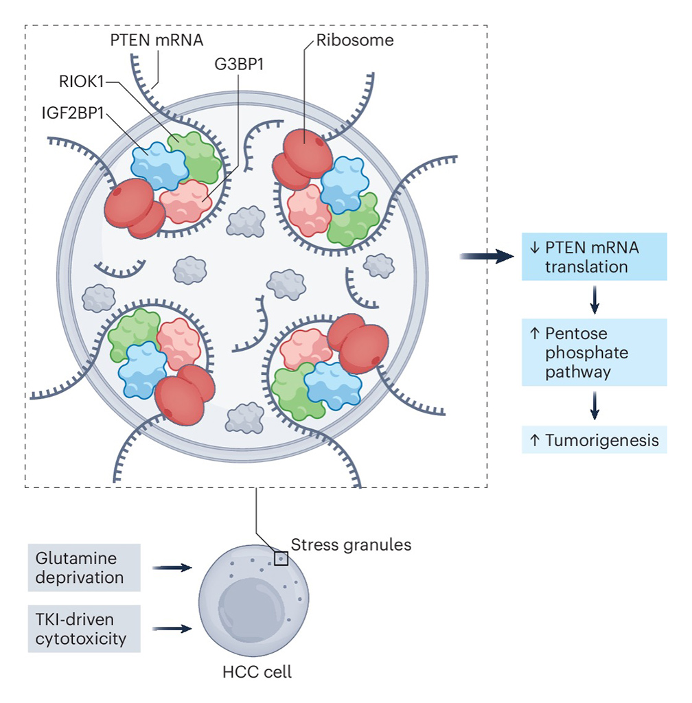 Formation of stress granules for metabolic reprogramming and stress adaptation in cancer.