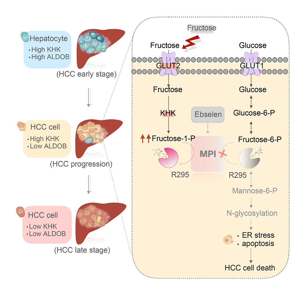 Figure: Dietary fructose inhibits HCC progression through F1P-mediated inhibition of MPI and protein N-glycosylation.