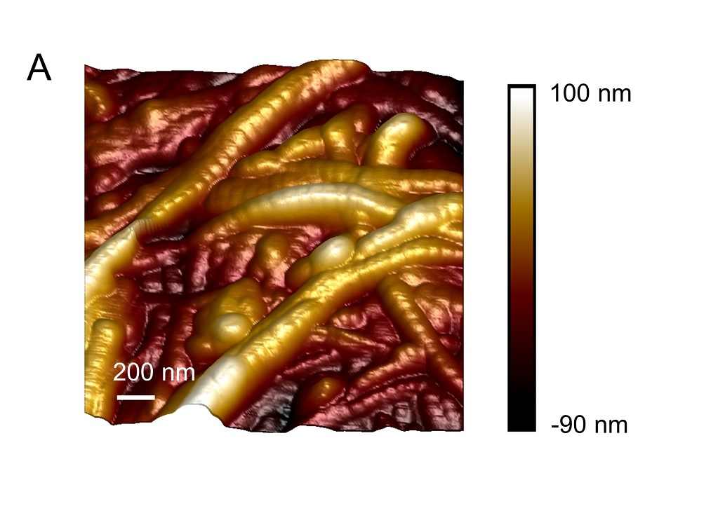 piezoelectricity 