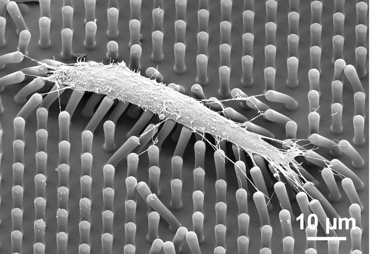 Opportunity Compact system suitable for point-of-care applications User-friendly operation, eliminating the need for medical personnel Cost-effective nanoimprint technology, facilitating mass production Highly sensitive biosensors for unique detection of nanometer-sized biomolecules Enables early disease detection and diagnosis Applicable to a variety of diseases Technology The invention features an engineered platform equipped with an array of plasmonic sensors on a base, serving as a biosensor for cell and biomolecule detection. Additionally, a separator is positioned atop the biosensors to distinguish cell protrusions from cell bodies, enabling the detection of nanometer-sized filopodia separated from micrometer-sized cell bodies for the first time Compact microfluidic system Nanoimprint technology for stacking multiple layers Plasmonic sensor for nanometer-sized biomolecule detection Separator to distinguish micrometer-sized cell bodies from nanometer-sized cell protrusions First time sensing of filopodia from cells for disease screening and cancer diagnosis Advantages First time demonstration of biosensing at nanometer dimensions High sensitivity due to advanced plasmonic sensors Compact microsystem that can be mass produced at low cost The only microfluidic system capable of distinguishing cell protrusions from cell bodies Low noise system for detection based on shift of resonance peaks Applications Compact, user-friendly, portable microsystem for point-of-care applications High-sensitivity biosensor for early disease screening and diagnosis Cost-effective production of plasmonic detector in integrated microfluidic system Detection of nanometer-sized filopodia and biomolecules Applicable to multiple diseases, including cancer