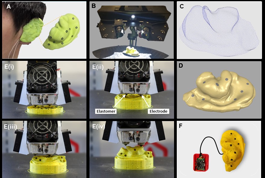 3 3D-printed personalized auricular sensor (3D-PAS) for simultaneously real-time bio-signal monitoring of multiple points across entire ear auricle.
