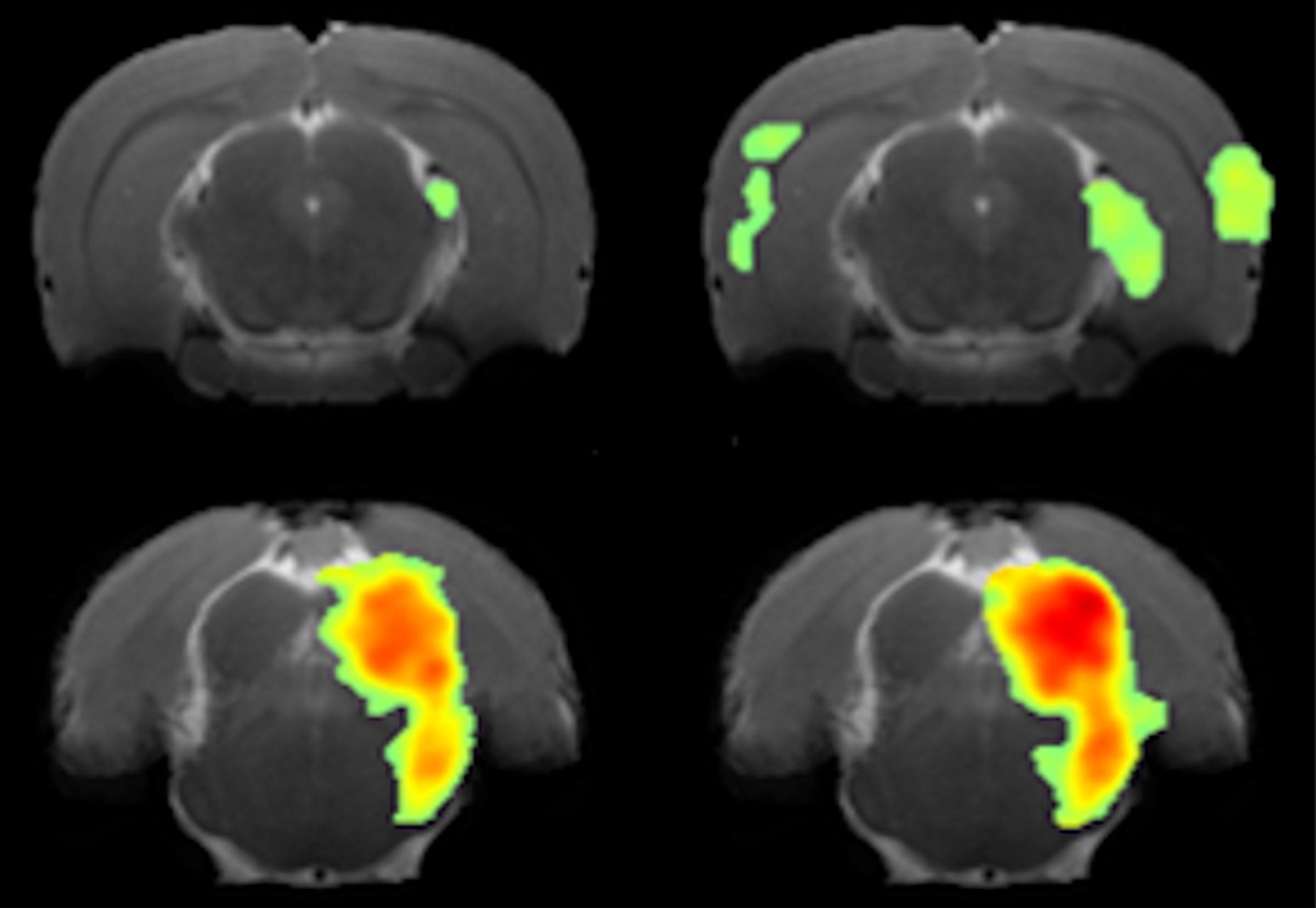 Functional imaging of sound hypersensitivity