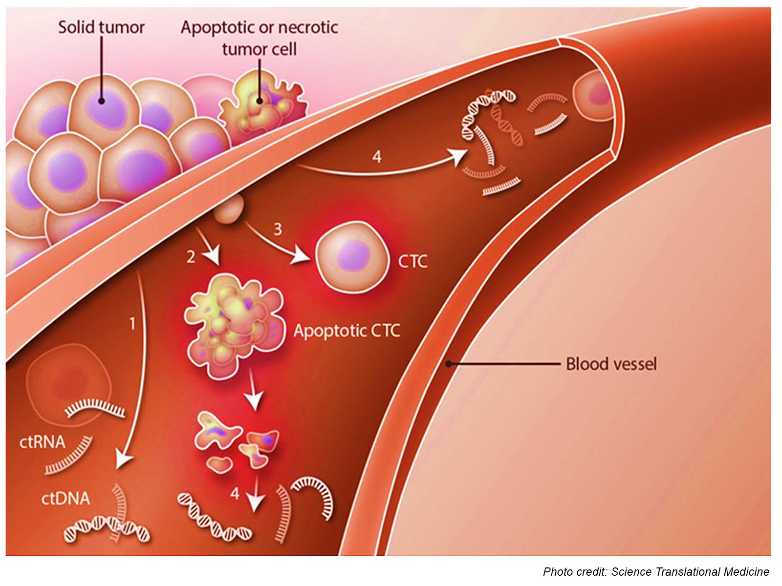 The new technology developed by CityU’s research team can circulating tumour cells in blood. Tumours as small as 0.1mm in the early stages of cancer can be detected.