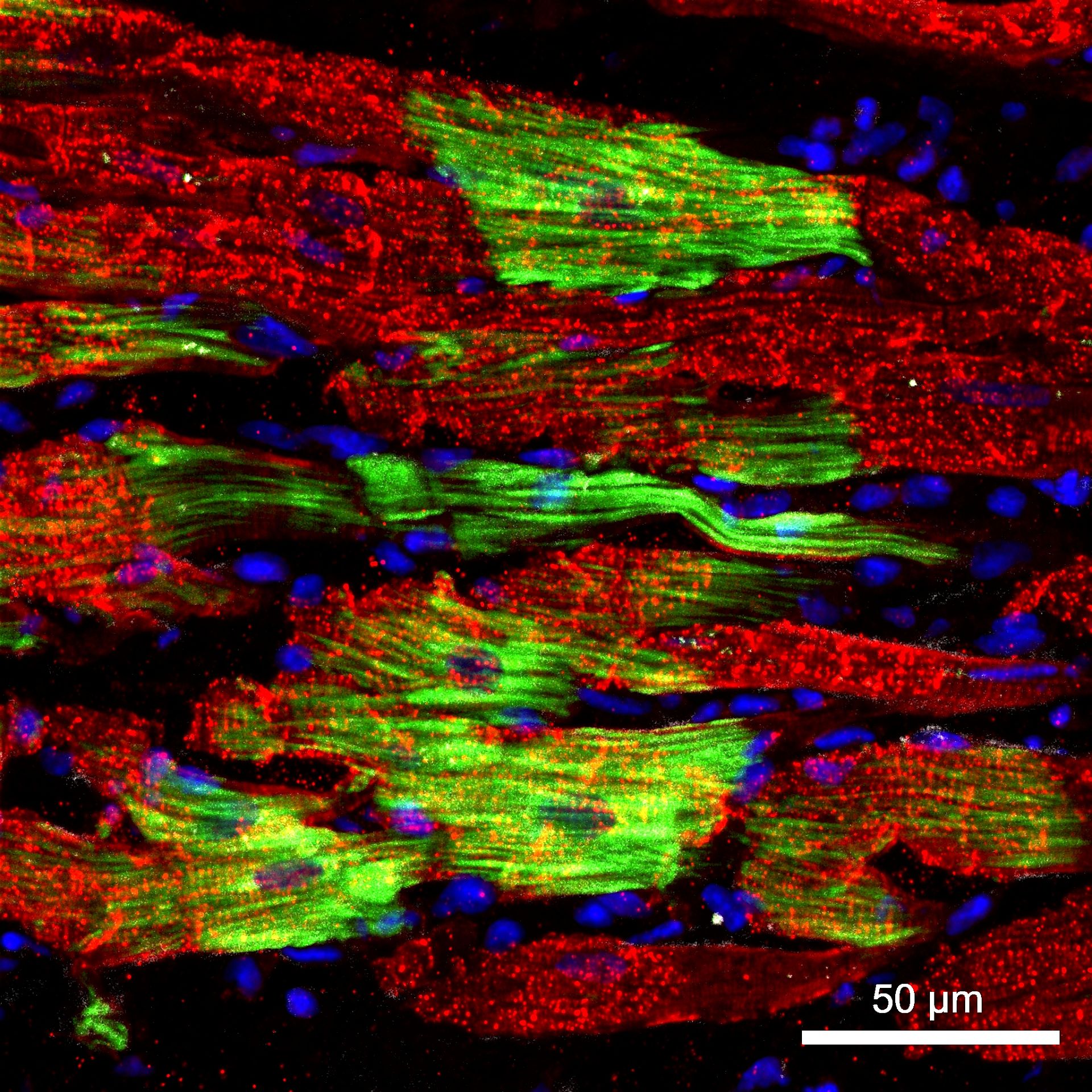 Representative immunostaining images with hiPSC-CM-GFP (green) and MYH6/7 gene (red). This figure indicated that the CM + PA group exhibited a much larger rod-shaped structure that resembled adult-like CMs. hMSC-PA improved the maturity of hiPSC-CMs