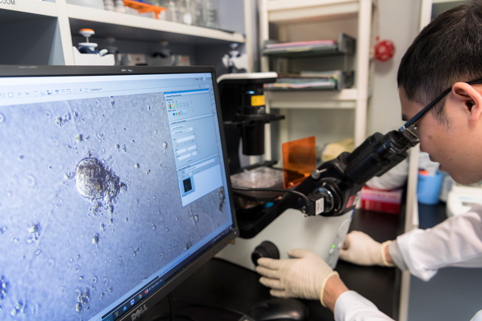 Breast cancer spheroids grown in Dr. Chin’s laboratory for identification of novel cancer driver genes.