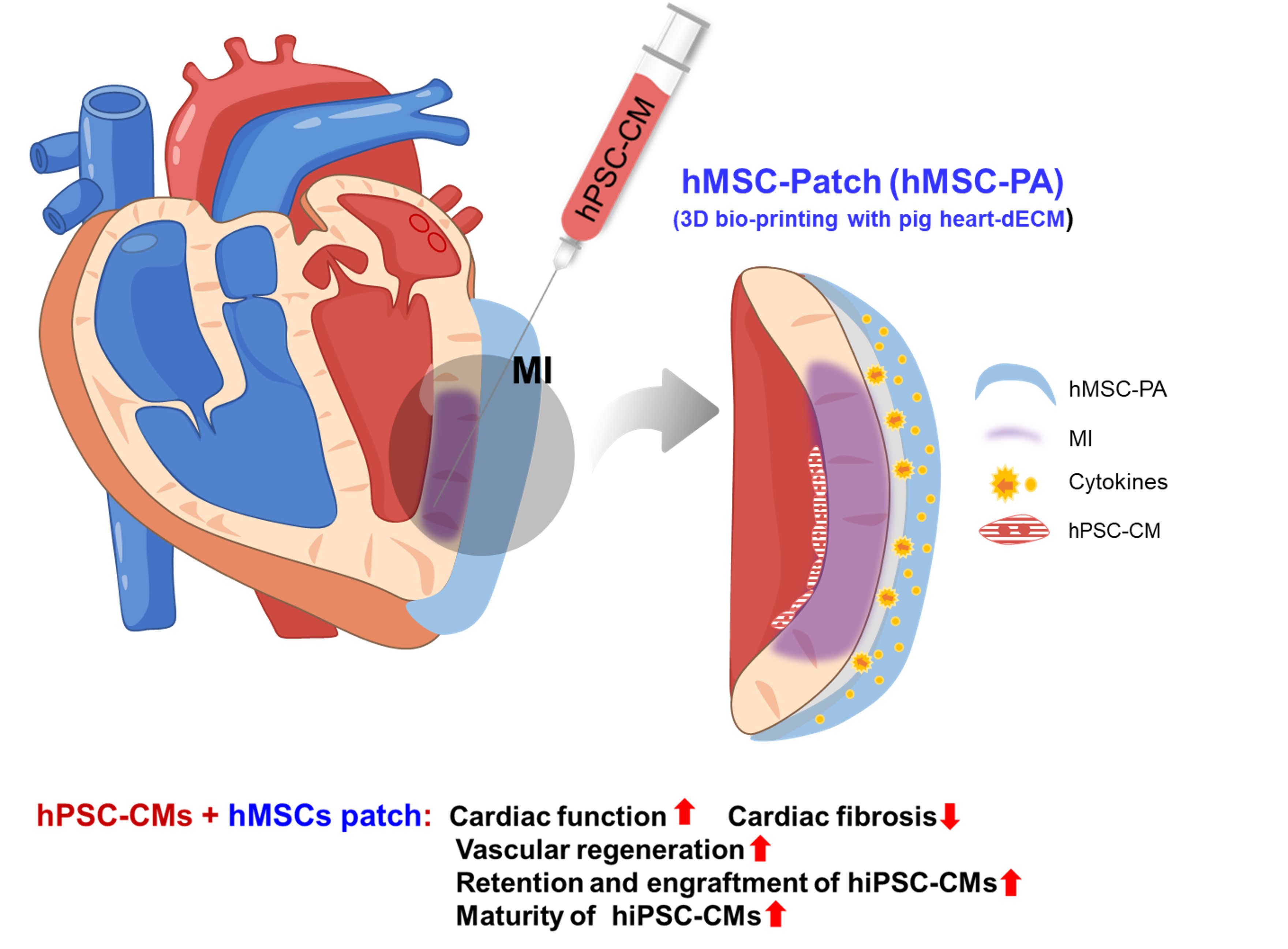 Schematic diagram of the underlying mechanism of dual treatment approach of hiPSC-CMs and hMSC-patch. (Photo source: Nature Communications, https://www.nature.com/articles/s41467-019-11091-2)