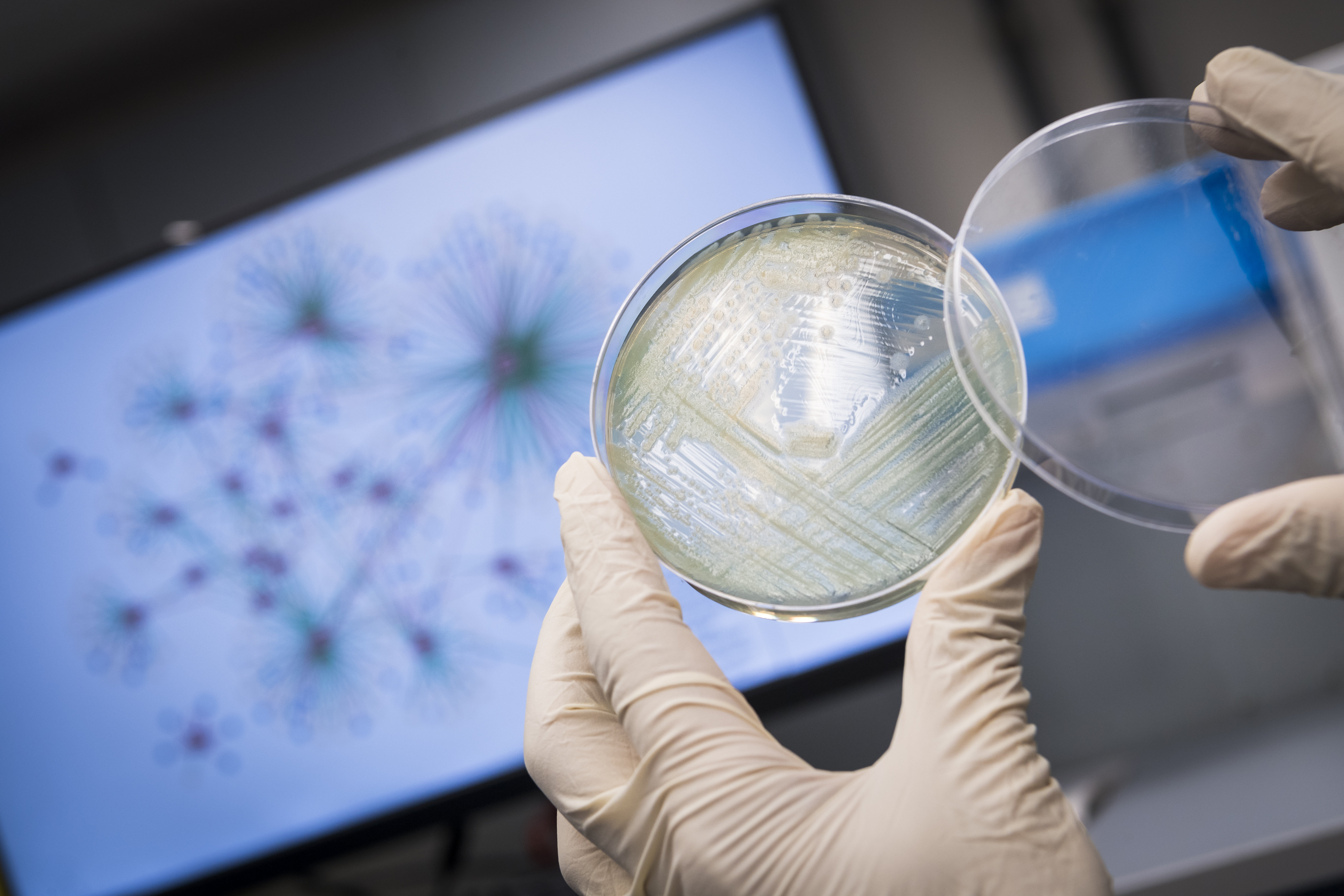 Pseudomonas aeruginosa, a superbug classified as one of the three “critical priority pathogens” that new drugs are urgently needed.