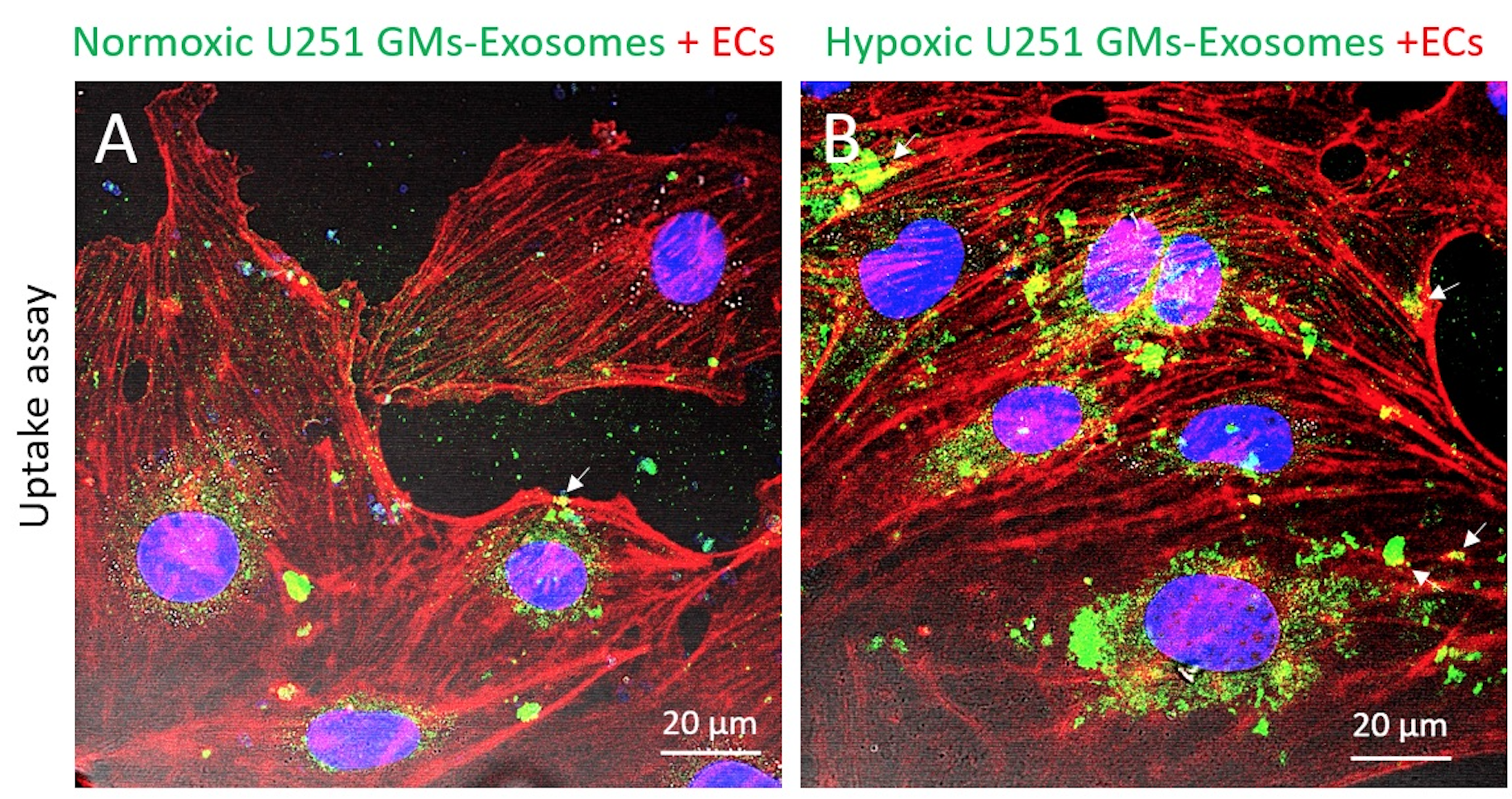 exosomes