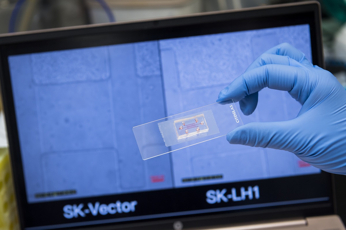 Microfluidic chips 